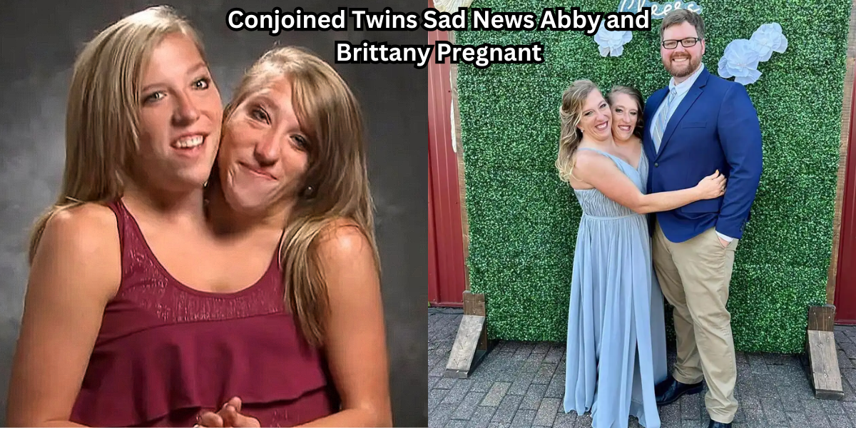 Conjoined Twins Sad News Abby and Brittany Pregnant